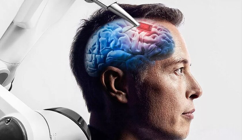Илон Маск: испытания мозговых чипов Neuralink на людях начнутся уже в этом году